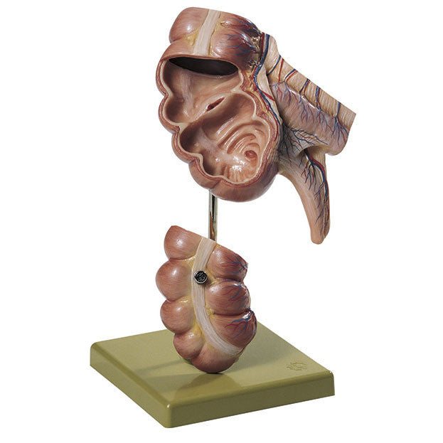 Appendix and Caecum Somso Js 7