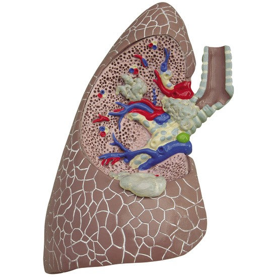 Lung Set (with Pathologies)