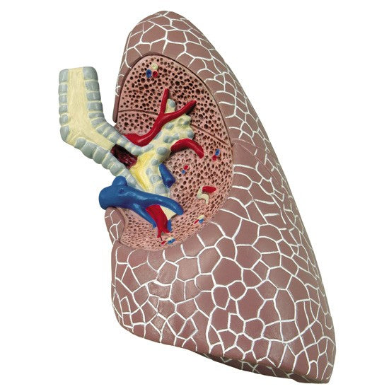 Lung Set (with Pathologies)