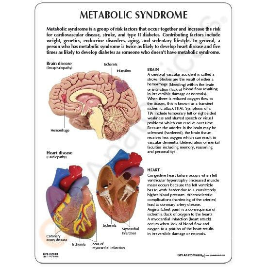 metabolic-syndrome-model-2-550x550__47840.1643511677.1280.1280.jpg