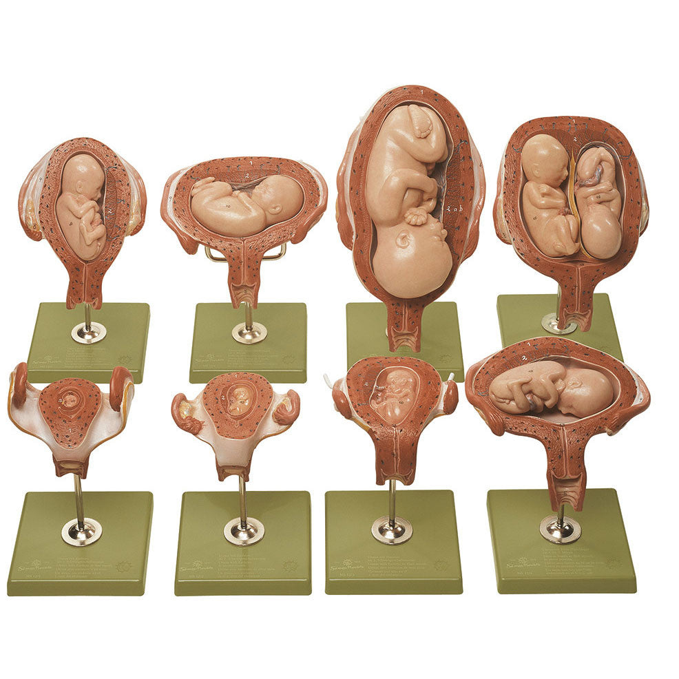 Series showing pregnancy Somso Ms 12