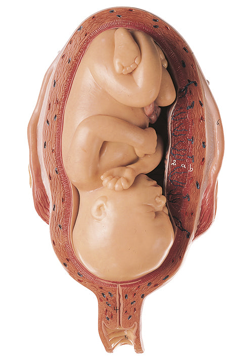 Uterus with Fetus in Seventh Month - Somso MS 12/7