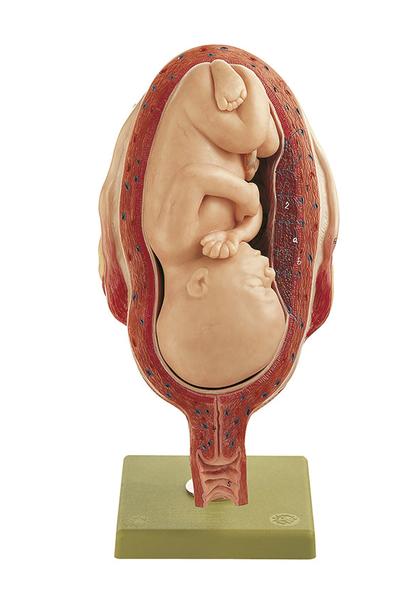 Uterus with Fetus in Seventh Month - Somso MS 12/7, view 2