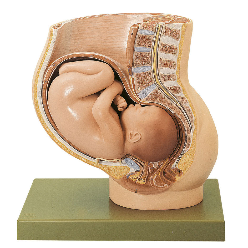 Pelvis with Uterus in Ninth Month of Pregnancy, 2 parts Somso Ms 13