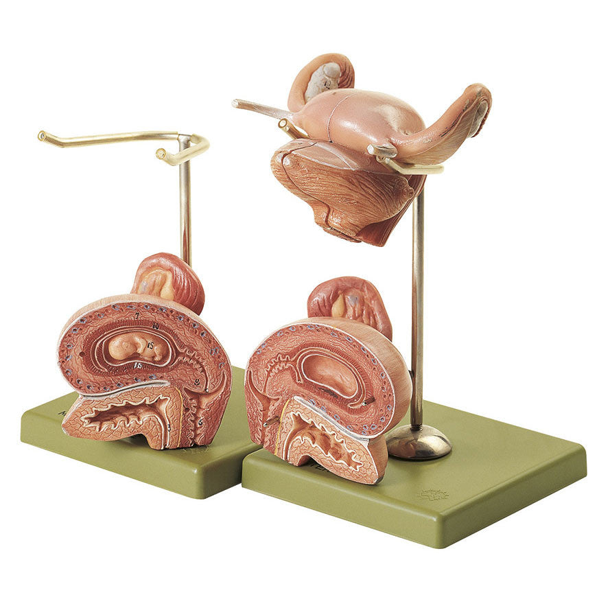 Internal Female Genital Organs, 2 parts Somso Ms 42