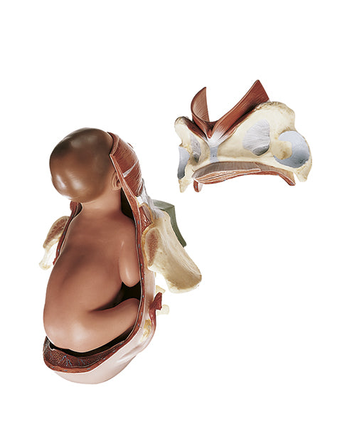 Birth - Second Stage - Somso MS 45/2, view 2