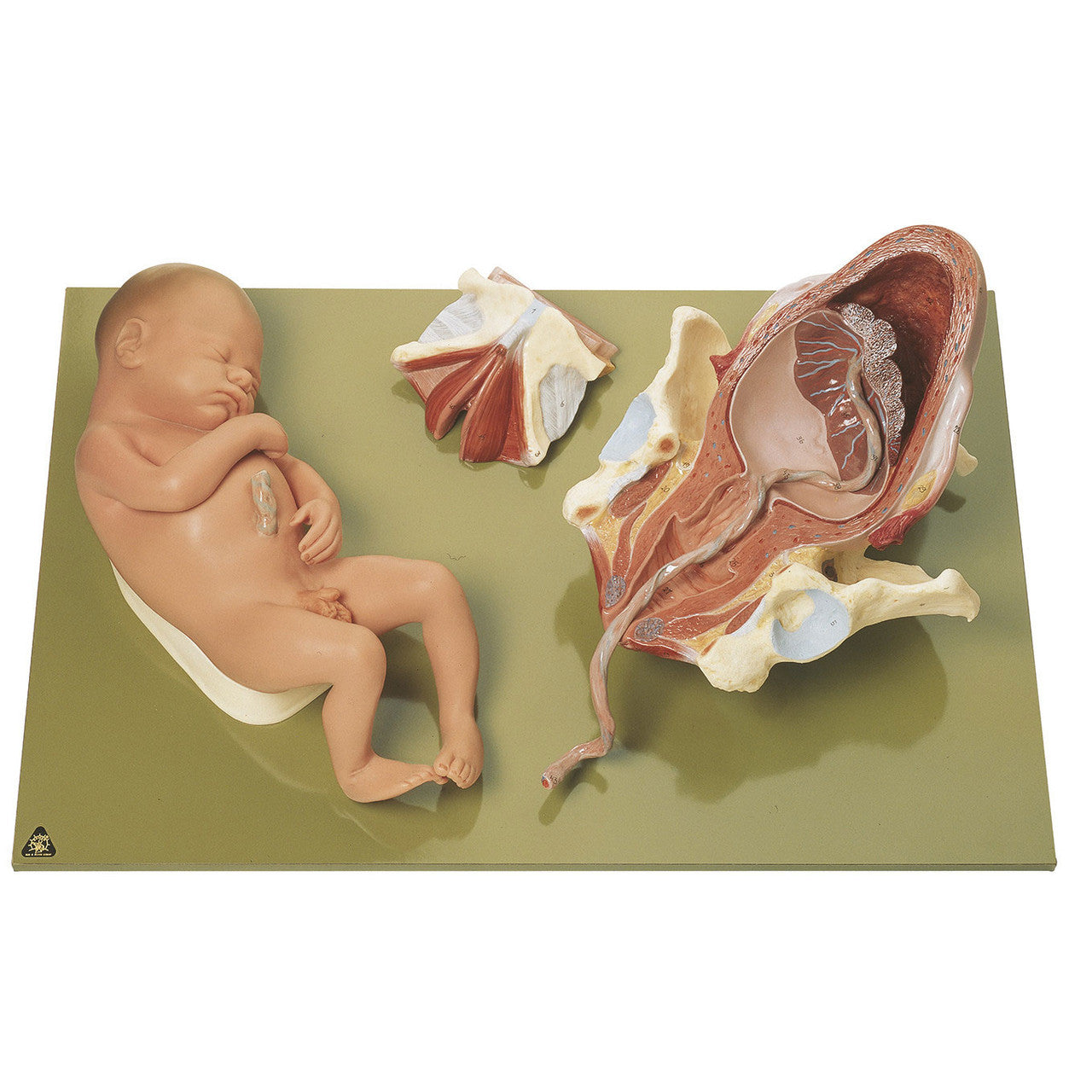 Birth - Third Stage Somso Ms 45/3