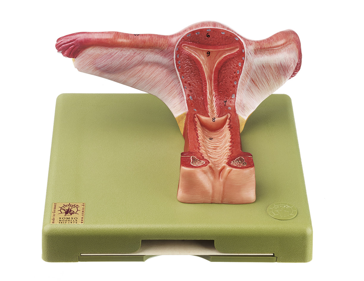 Female Genital Organs - Somso MS 4