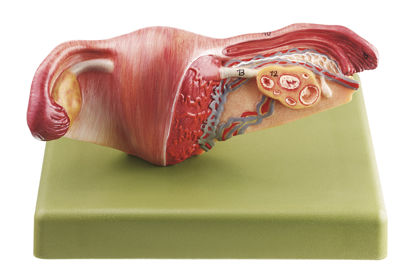 Female Genital Organs - Somso MS 4, view 2