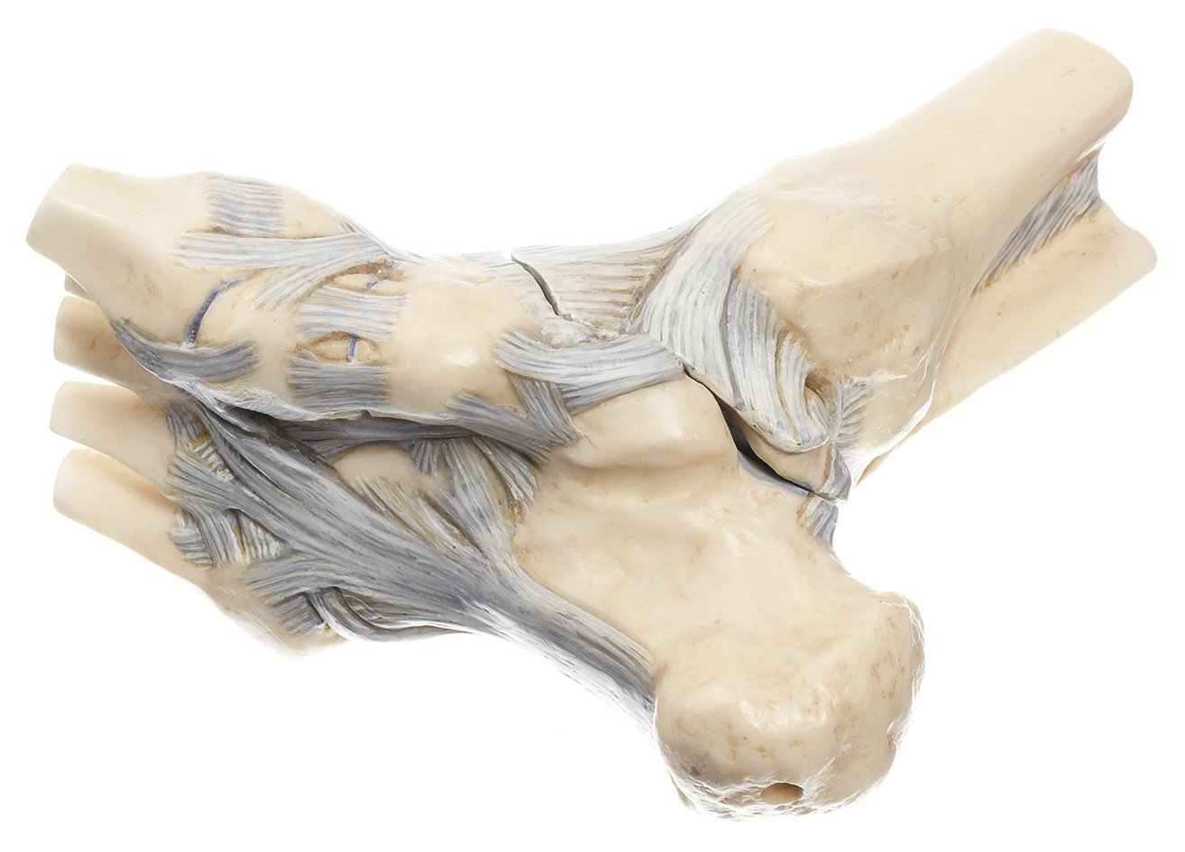 Ligaments of the Ankle w. Open Talonavicular Joint