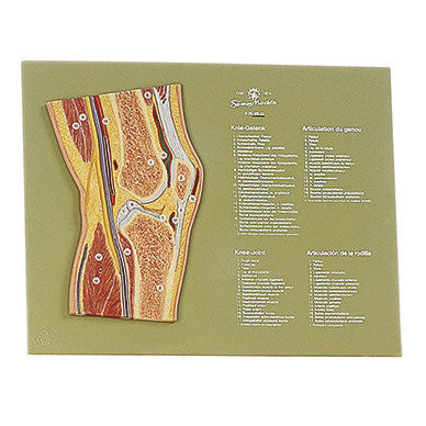 Section through the Knee Joint Somso Ns 43