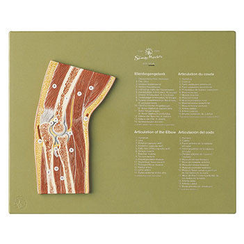 Section through the Elbow Joint Somso Ns 46