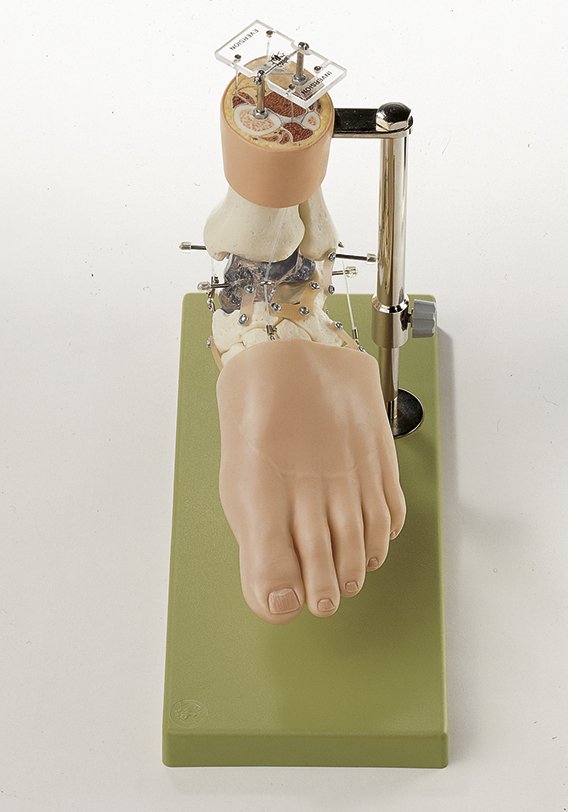 Functional Model of the Tarsus