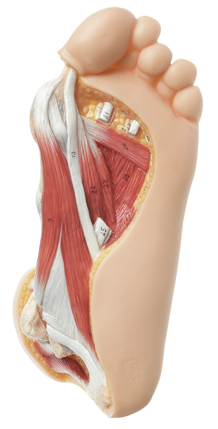 Hallux Valgus Model