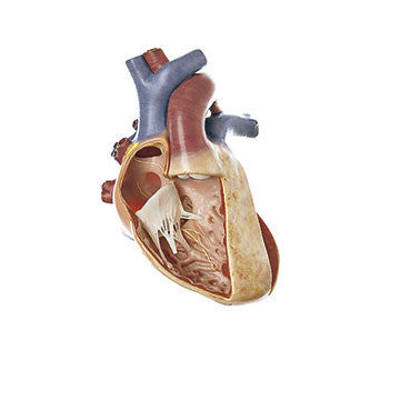 Transposition of Large Vessels Somso Os 7/1