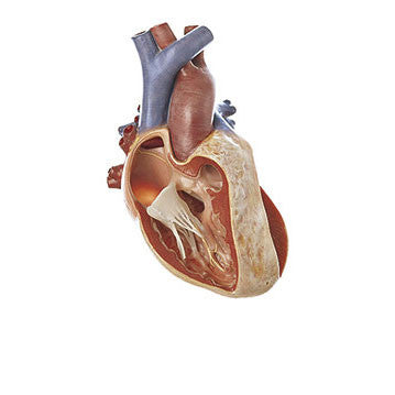 Fallot's Tetralogy Somso Os 7/2