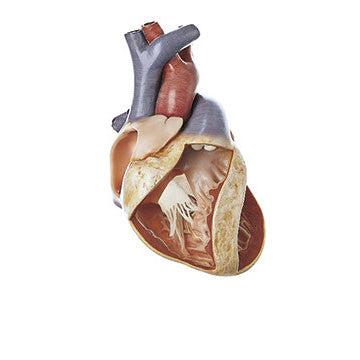 Total Atrioventricular Canal Somso Os 7/4
