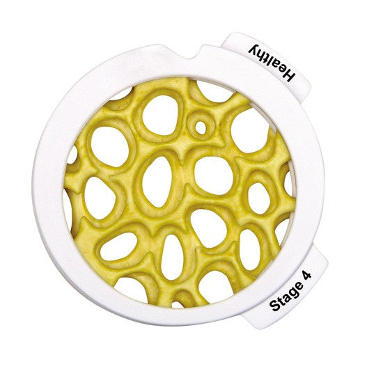 Osteoporosis Hinged Disk Set