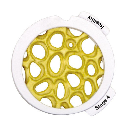 osteoporosis-hinged-disk-set-2__04492.1643511676.1280.1280.jpg