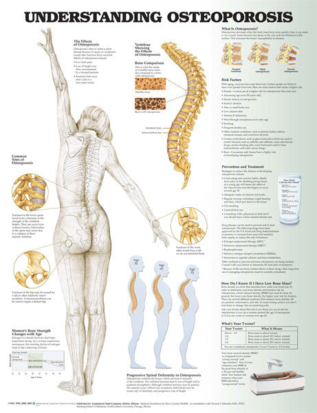 osteoporosis__62586.1589753136.1280.1280.jpg