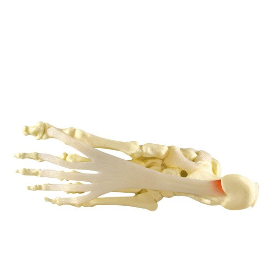 Foot/Ankle (Plantar Fasciitis)