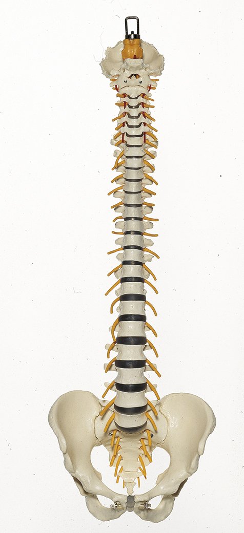 Vertebral Column with Pelvis, healthy and pathological