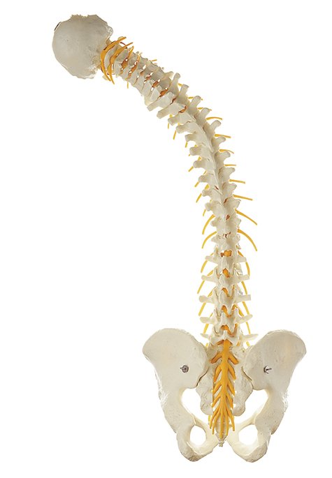 Vertebral Column with Pelvis, healthy and pathological