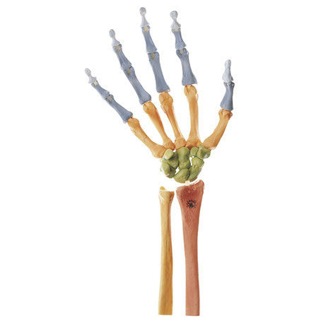 Skeleton of the Hand, Right Somso Qs 31/4