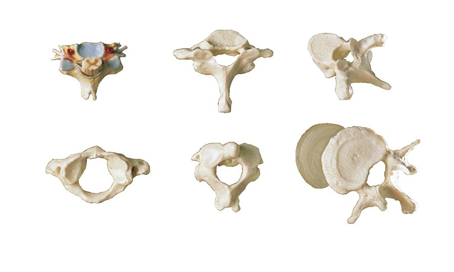 Collection Case “Vertebrae and Spinal Cord“