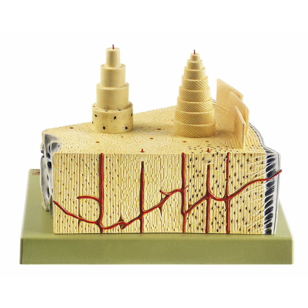Bone Structure Somso Qs 61