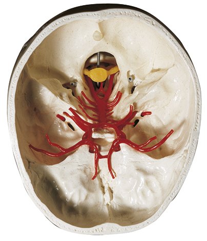 Artificial Base of Skull with Arteries