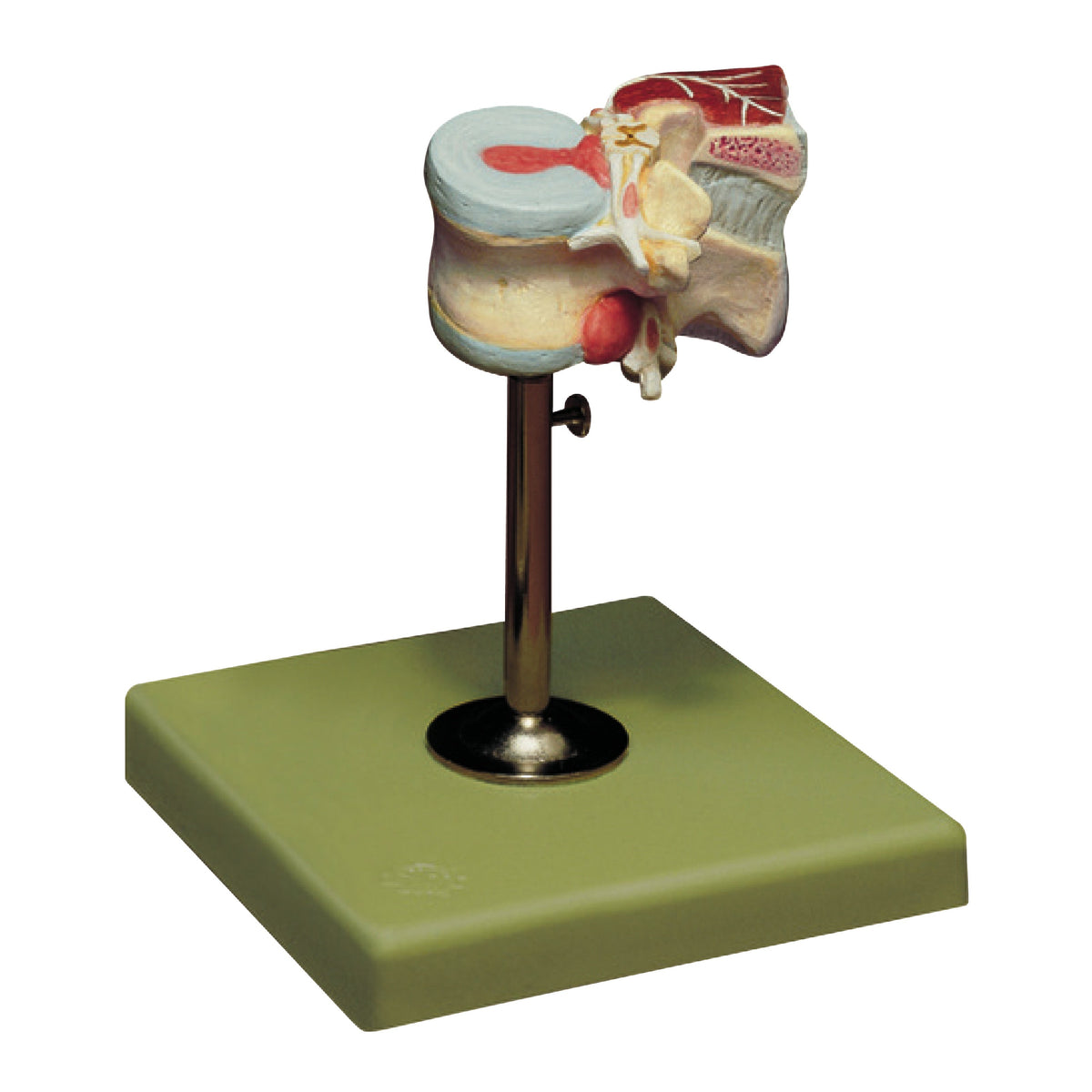 QS 68/1 first lumbar vertebra model, detailed view showing herniated discs and dorsal muscles