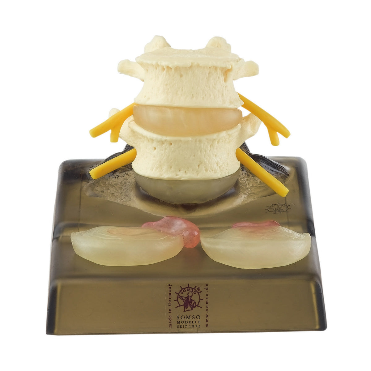 QS 68/3 central and dorsolateral herniated disc model, detailed view on transparent base
