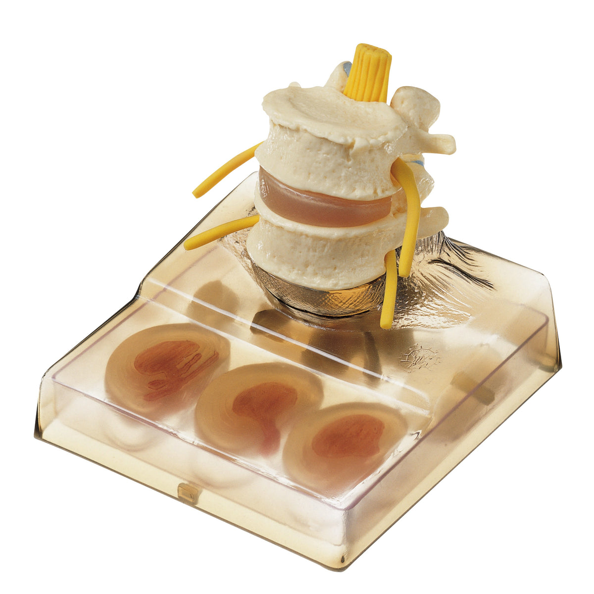 QS 68/8 intervertebral disc model, detailed view showing normal anatomy and pathological changes