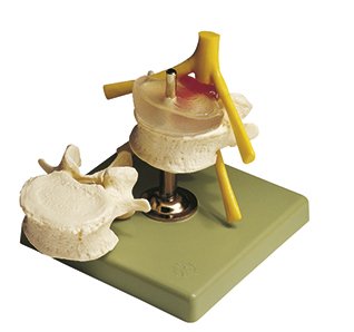 QS 68 hernia of central intervertebral disc model, product photo