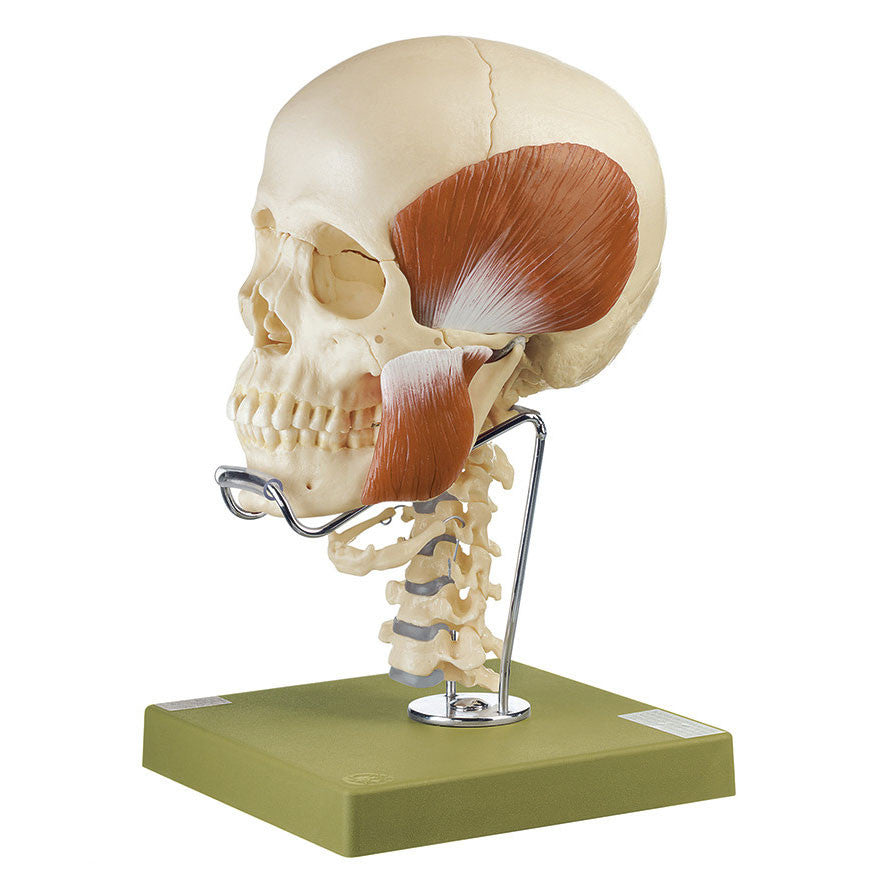 14-Part Model of the Skull with Cervical Spine and Masticatory Muscles Somso Qs 8/2C+M