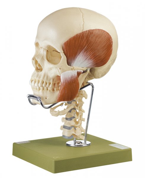 14-Piece Model of the Skull with Masticatory Muscles and Cervical Vertebral Column and Hyoid Bone