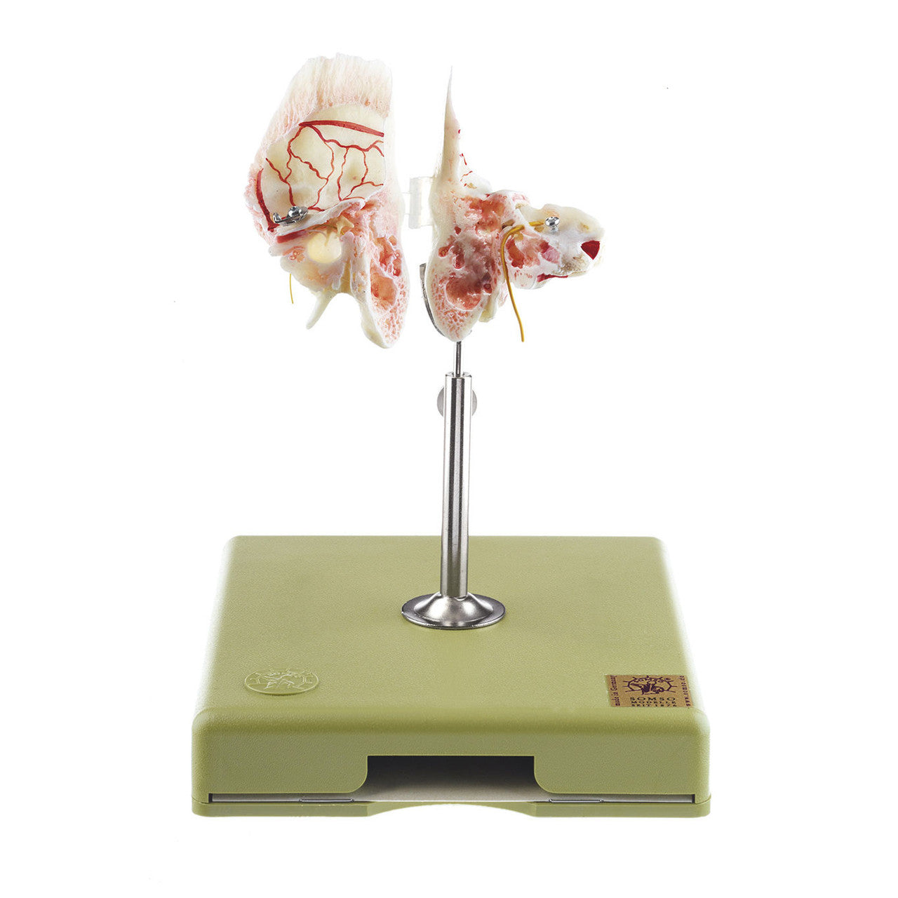 Artificial Temporal Bone, 2 parts Somso Qs 8/53