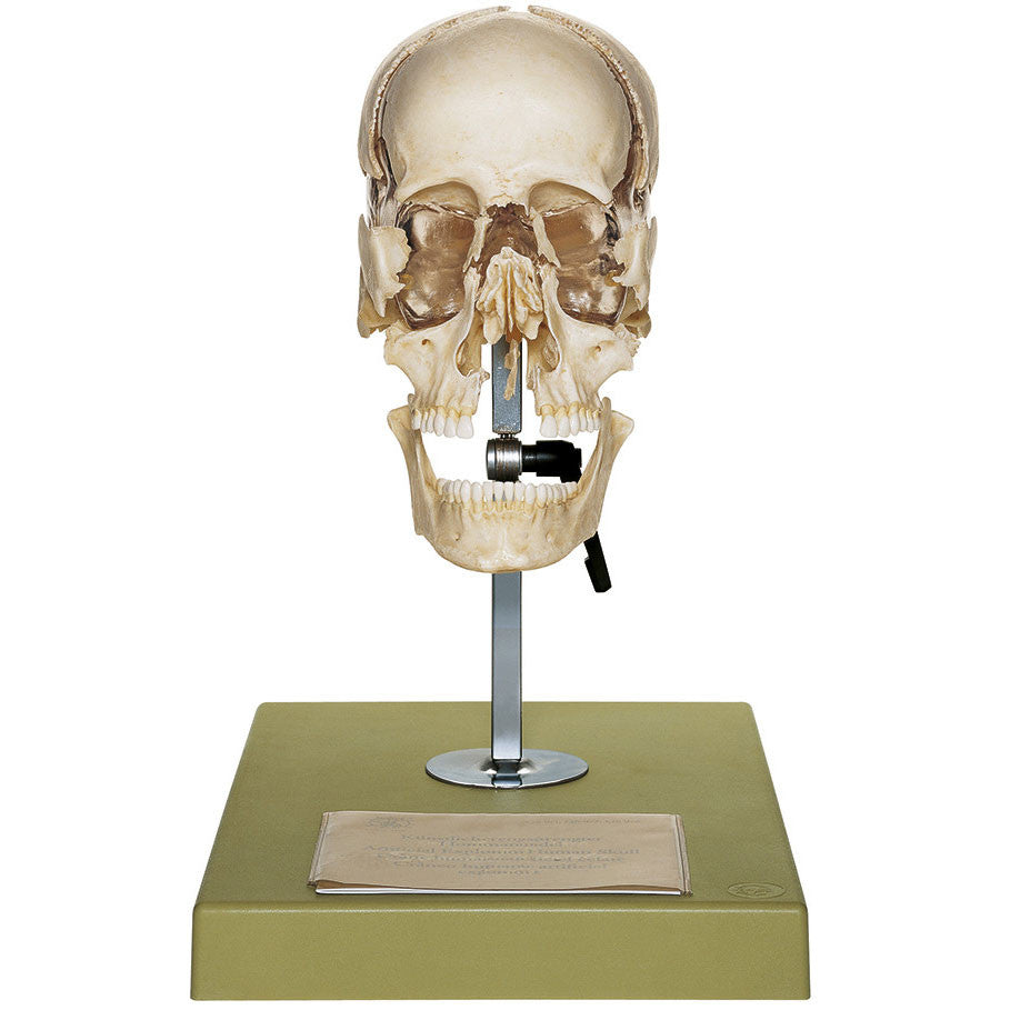 Artificial Bauchene Skull of an Adult, Mounted Somso Qs 9