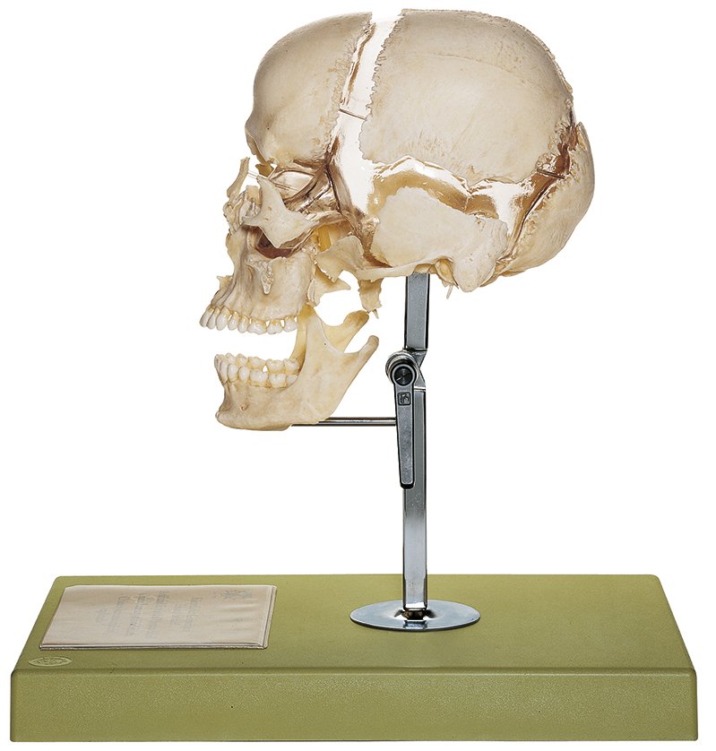Artificial Bauchene Skull of an Adult, Mounted