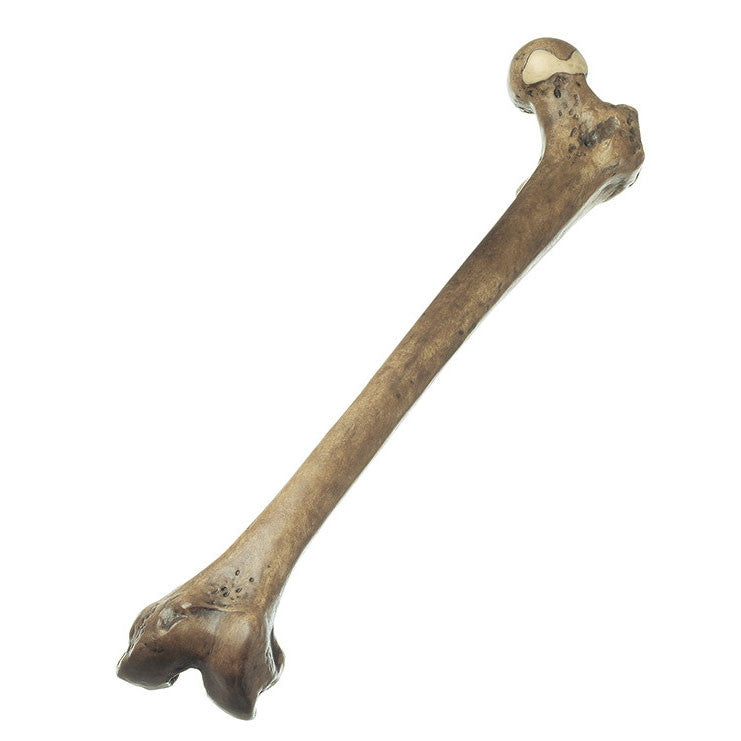 Reconstruction of a Thigh of Homo erectus | Somso S 2/F