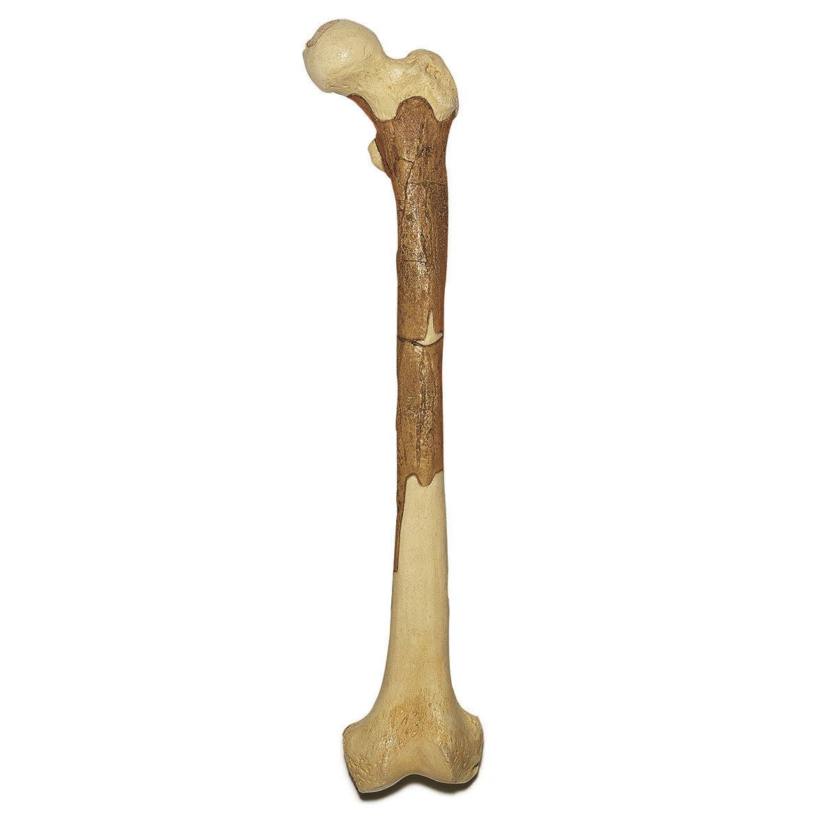 Reconstruction of a Thigh of Homo ergaster | Somso S 2/KNM
