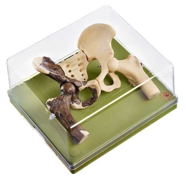 Reconstruction of a Pelvis of Australopithecus africanus