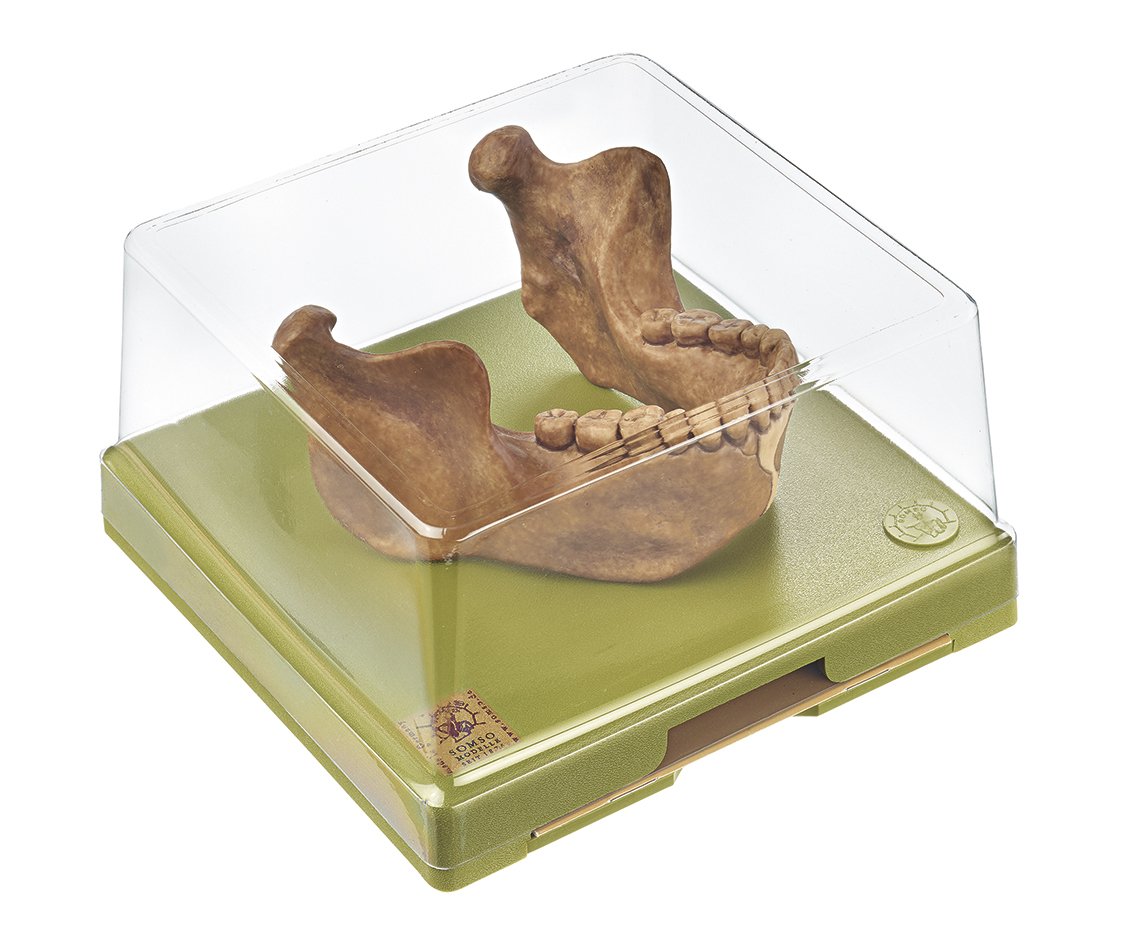 Lower Jaw from Mauer near Heidelberg, Homo heidelbergensis