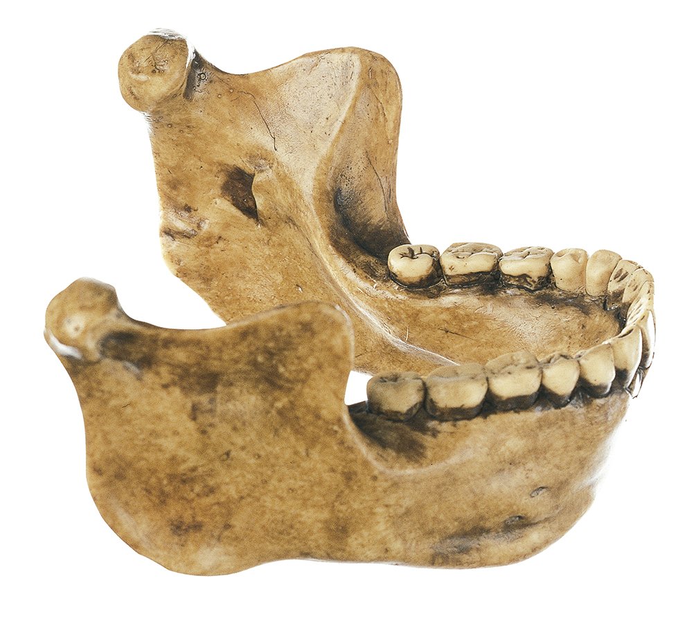 Lower Jaw from Mauer near Heidelberg, Homo heidelbergensis