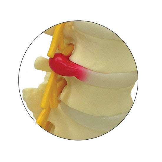 sacrum-model-2__45768.1643511676.1280.1280.jpg