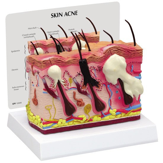 skin-acne-model-1__34393.1643511677.1280.1280.jpg