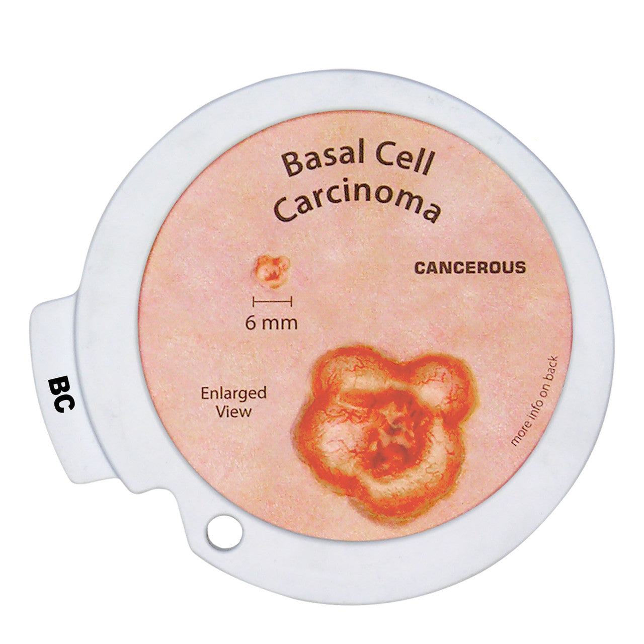 skin-lesions-model-BC__76920.1643511677.1280.1280.jpg