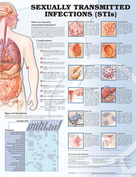 stis__76664.1589753304.1280.1280.jpg