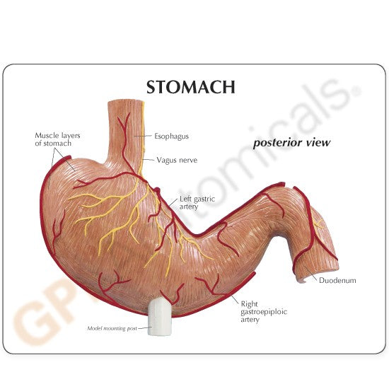 Stomach (with Ulcers)